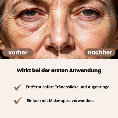 Luméa Augenstraffer